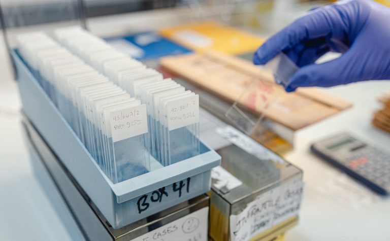 microscope glass slide with hand in blue blue glove. research